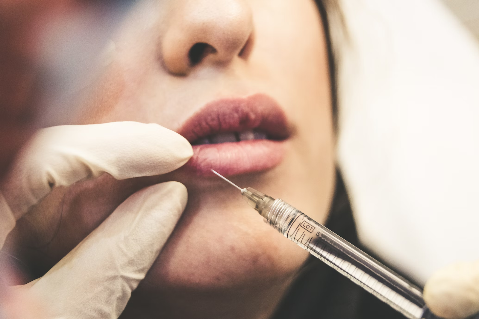 Facial Fillers: Your Guide to a More Youthful Appearance