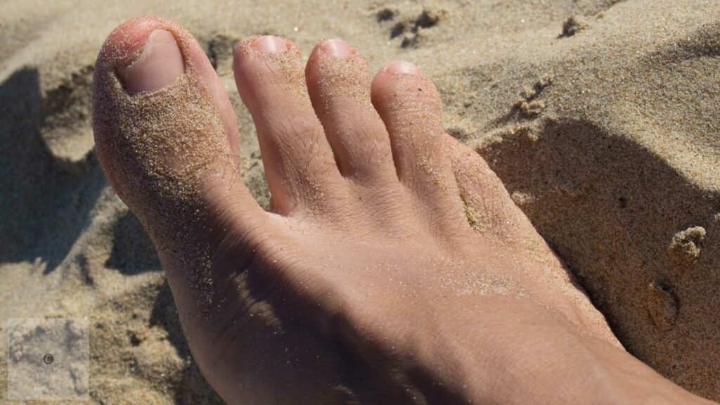 prevent onychomycosis