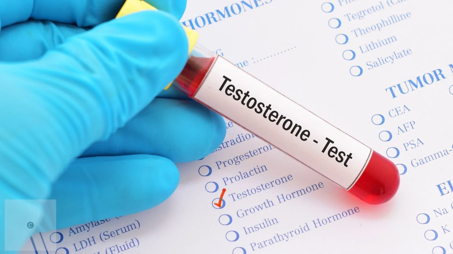 testosterone therapy for mental health