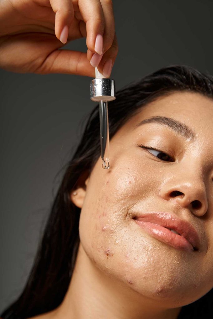 dermatologist acne treatments